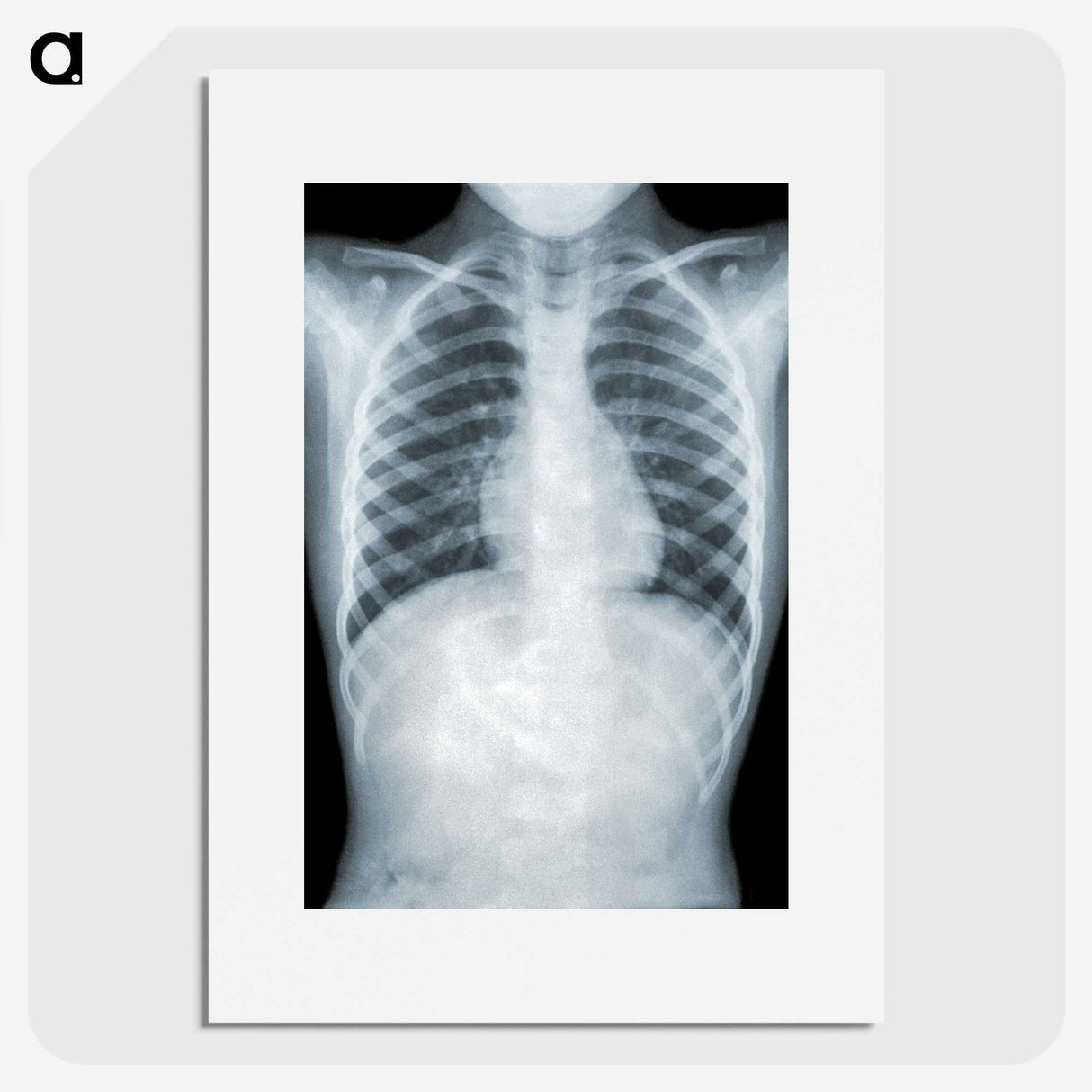 1-5_COVID-19_picture