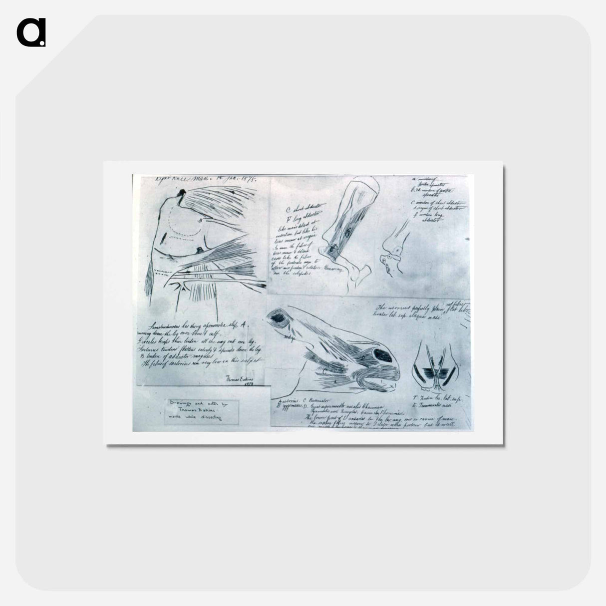 アートポストカード-Anatomical studies - トーマス エイキンズ Postcard.