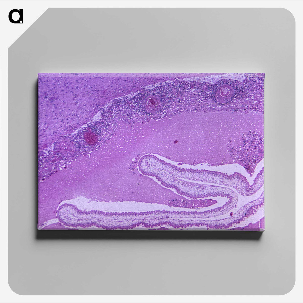 2-32_COVID-19_canvas