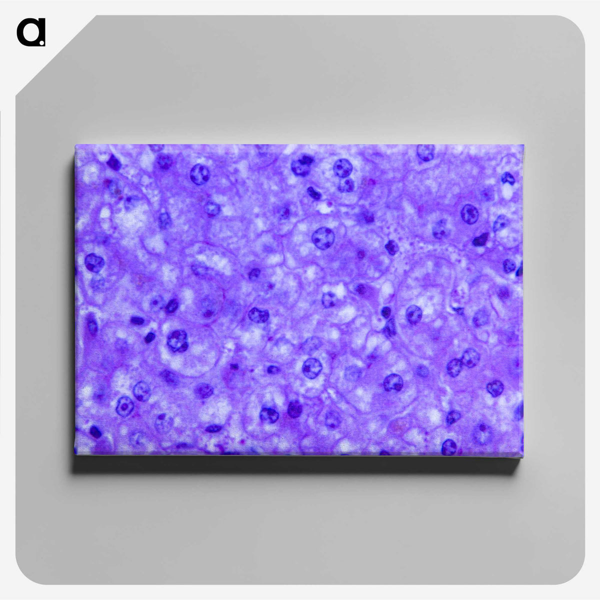 3-14_COVID-19_canvas