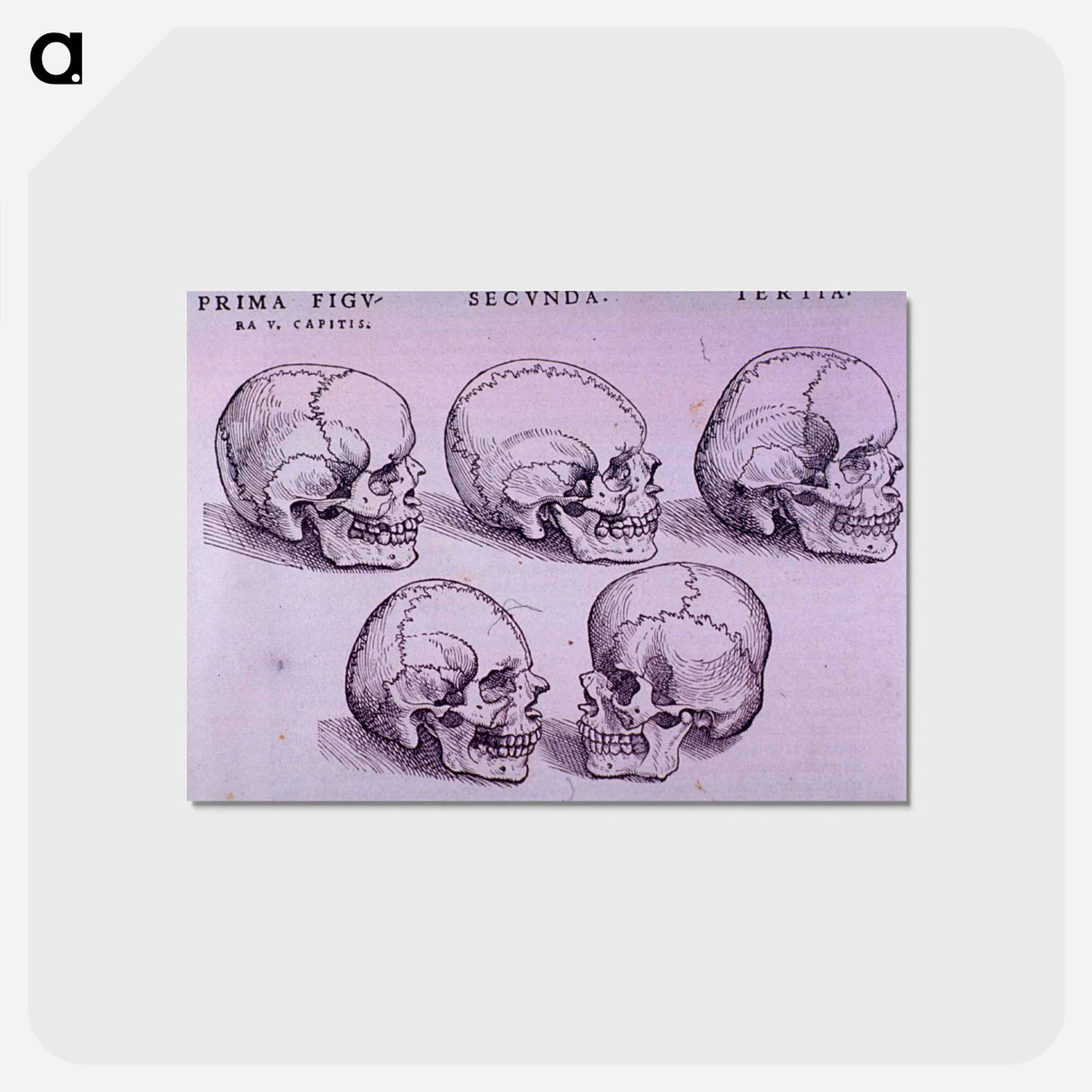 アートポストカード-Bone Plate: Five Malformations of the Skull
- 国立医学図書館 Postcard.