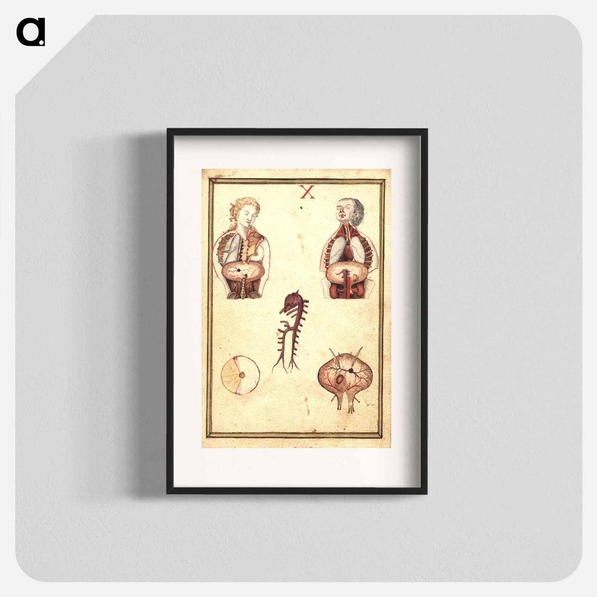 アートポスター-Anatomical Study of Flayed Chests
- 国立医学図書館 Poster.