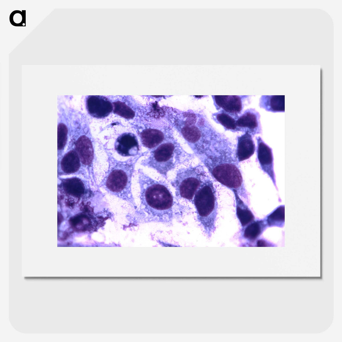 3-65_COVID-19_picture
