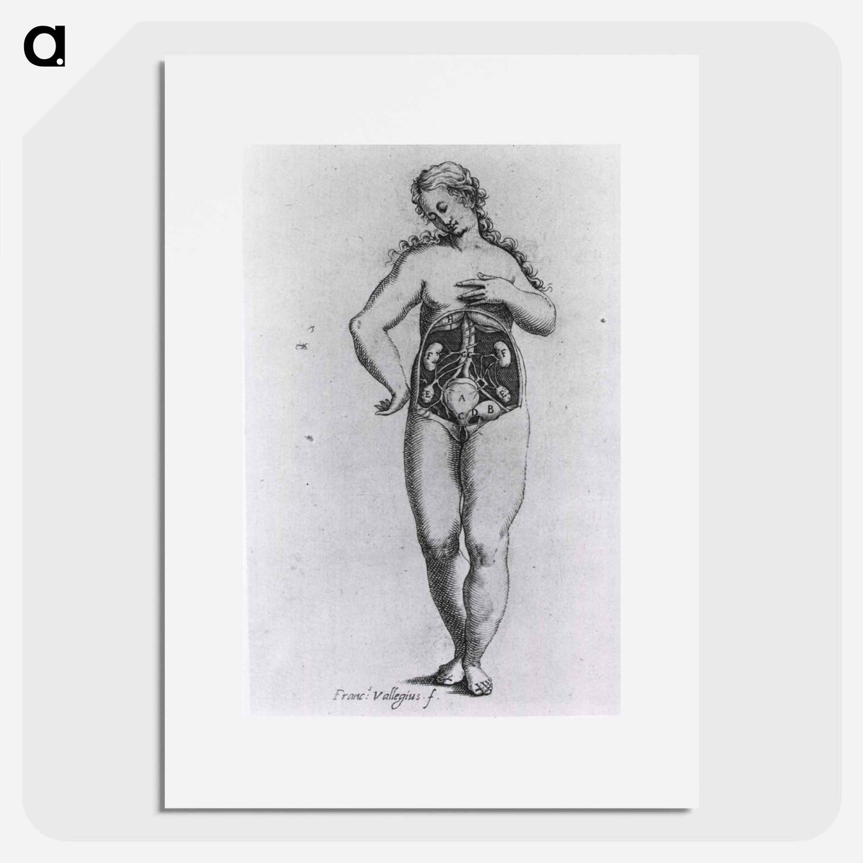 アートポスター-Nude Female Figure with Anatomical View of Urogenital System
- 国立医学図書館 Poster.