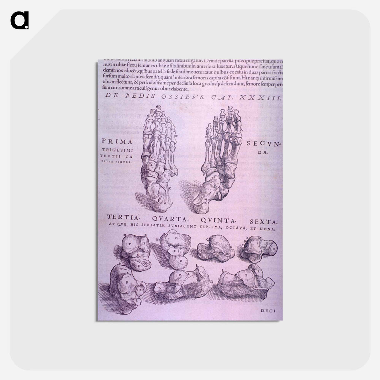 アートポストカード-Superior and Inferior Views of a Bone Plate
- 国立医学図書館 Postcard.
