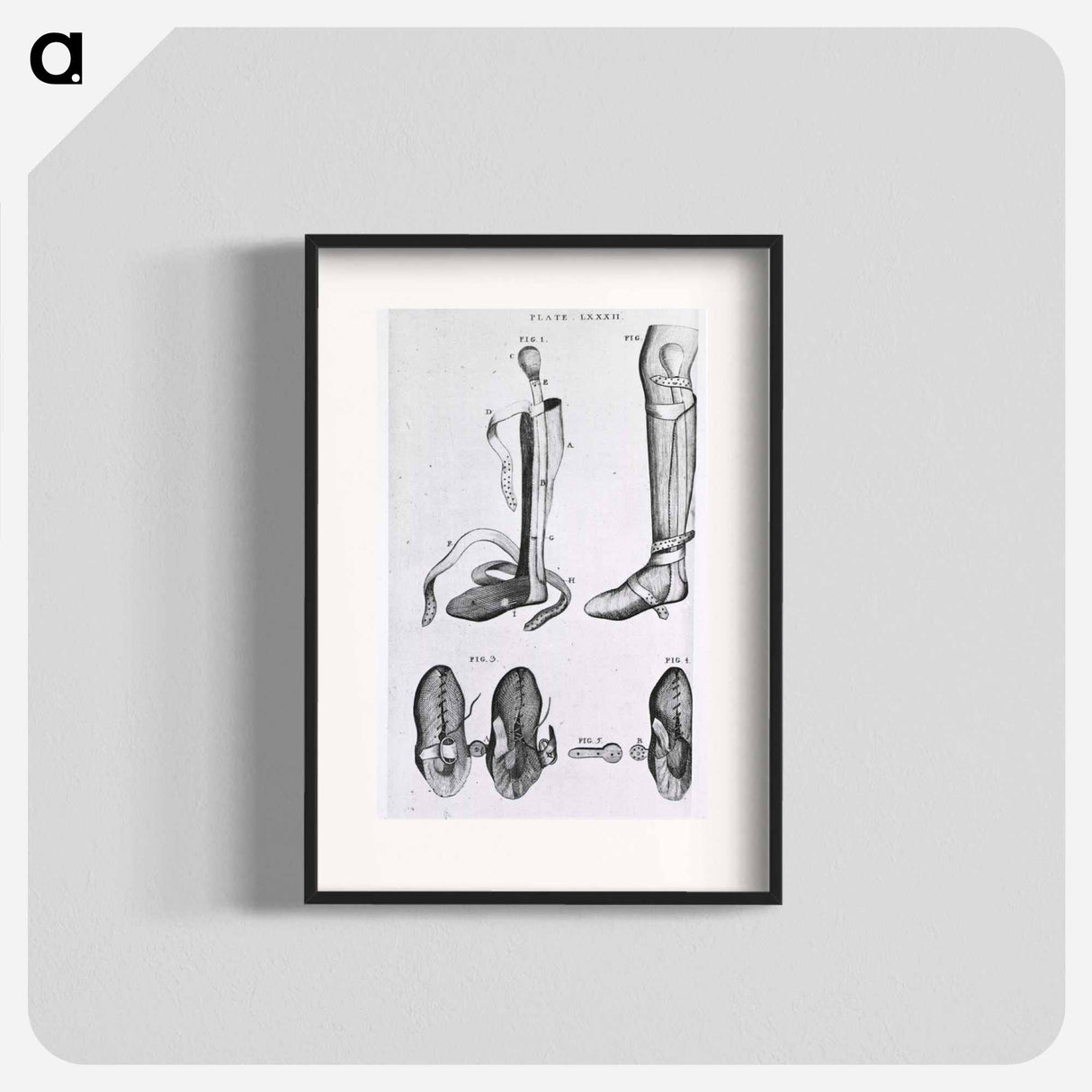 アートポスター-Leg Braces and Corrective Shoes
- 国立医学図書館 Poster.