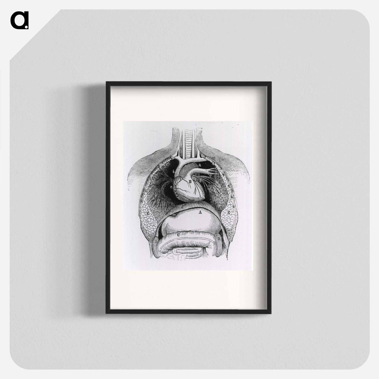 アートポスター-Distended Stomach and Colon
- 国立医学図書館 Poster.