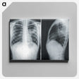 1-24_COVID-19_canvas