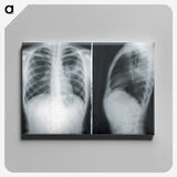 1-24_COVID-19_canvas
