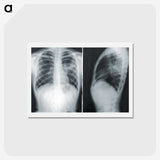 1-24_COVID-19_hagaki