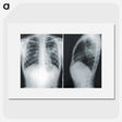 1-24_COVID-19_picture