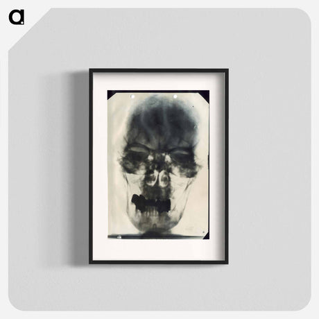 アートポスター-Radiograph of Adolf Hitler's Cranium
 - 国立医学図書館 Poster.