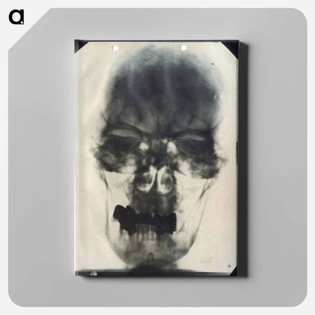 アートパネル-Radiograph of Adolf Hitler's Cranium
 - 国立医学図書館 Canvas.