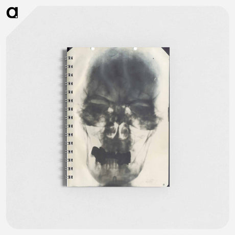 アートメモ帳-Radiograph of Adolf Hitler's Cranium
 - 国立医学図書館 Memo.