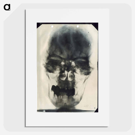 アートポスター-Radiograph of Adolf Hitler's Cranium
 - 国立医学図書館 Poster.