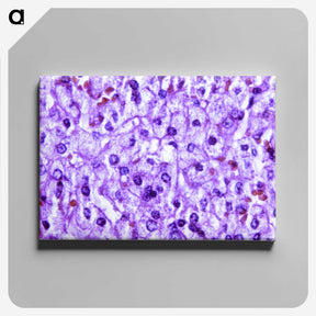 1-40_COVID-19_canvas