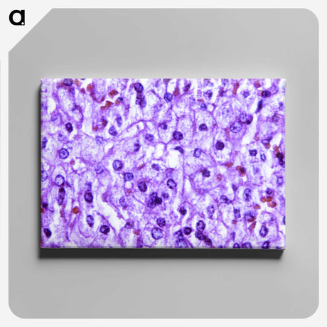 1-40_COVID-19_canvas