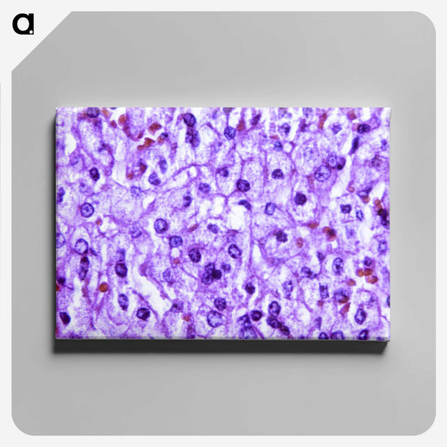 1-40_COVID-19_canvas