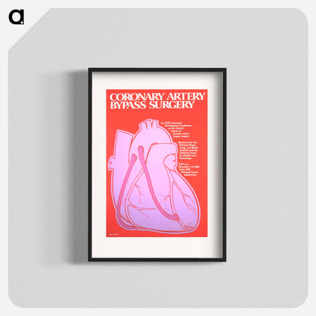 アートポスター-Coronary Artery Bypass Surgery Poster
 - 国立医学図書館 Poster.