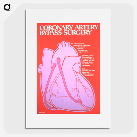 アートポスター-Coronary Artery Bypass Surgery Poster
 - 国立医学図書館 Poster.