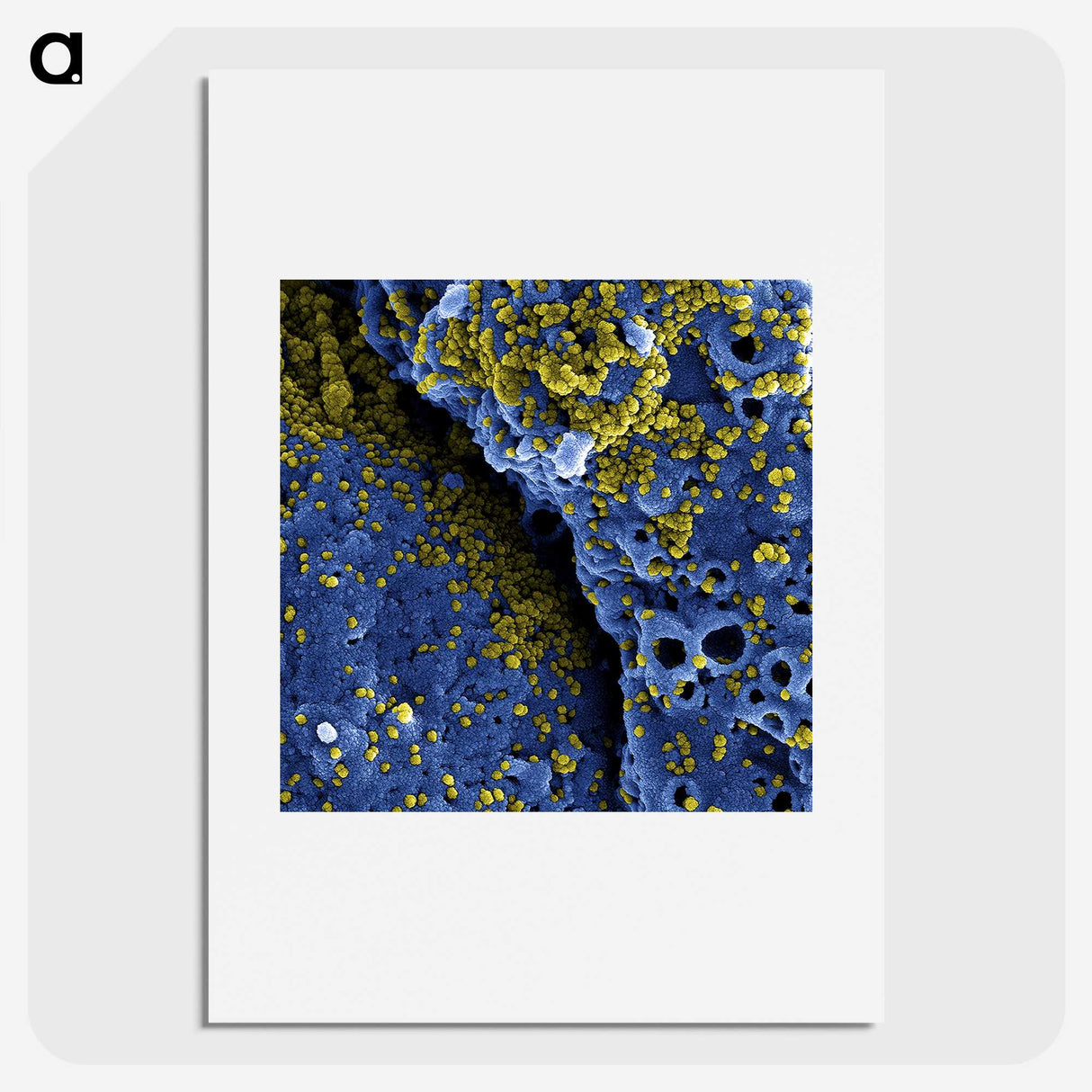 1-51_COVID-19_picture