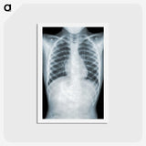 1-5_COVID-19_hagaki