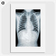 1-5_COVID-19_picture