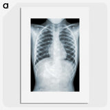 1-5_COVID-19_picture