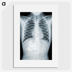 1-5_COVID-19_picture