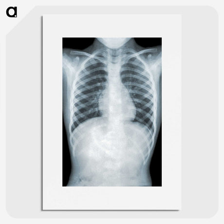 1-5_COVID-19_picture