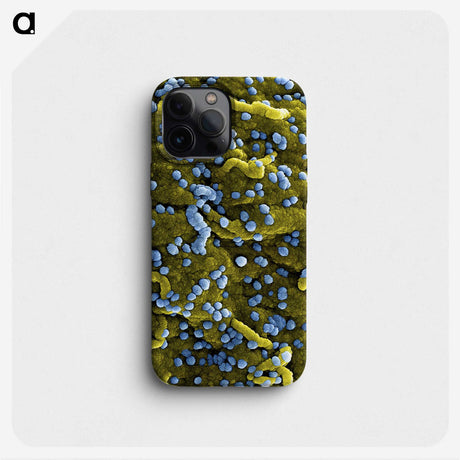 1-70_COVID-19_phone