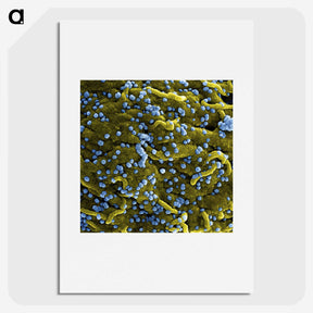 1-70_COVID-19_picture