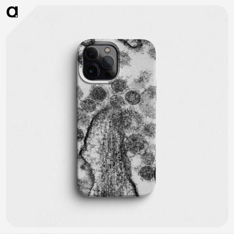 1-73_COVID-19_phone
