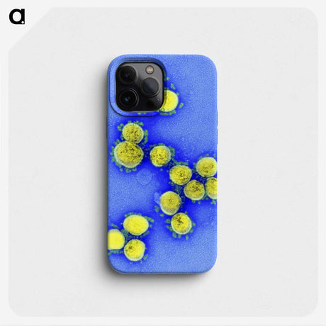 1-77_COVID-19_phone