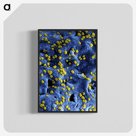 1-80_COVID-19_blk-crop