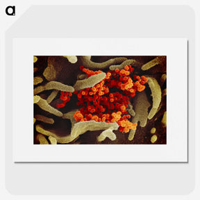 1-83_COVID-19_picture