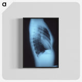 1-87_COVID-19_blk-crop