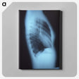 1-87_COVID-19_canvas
