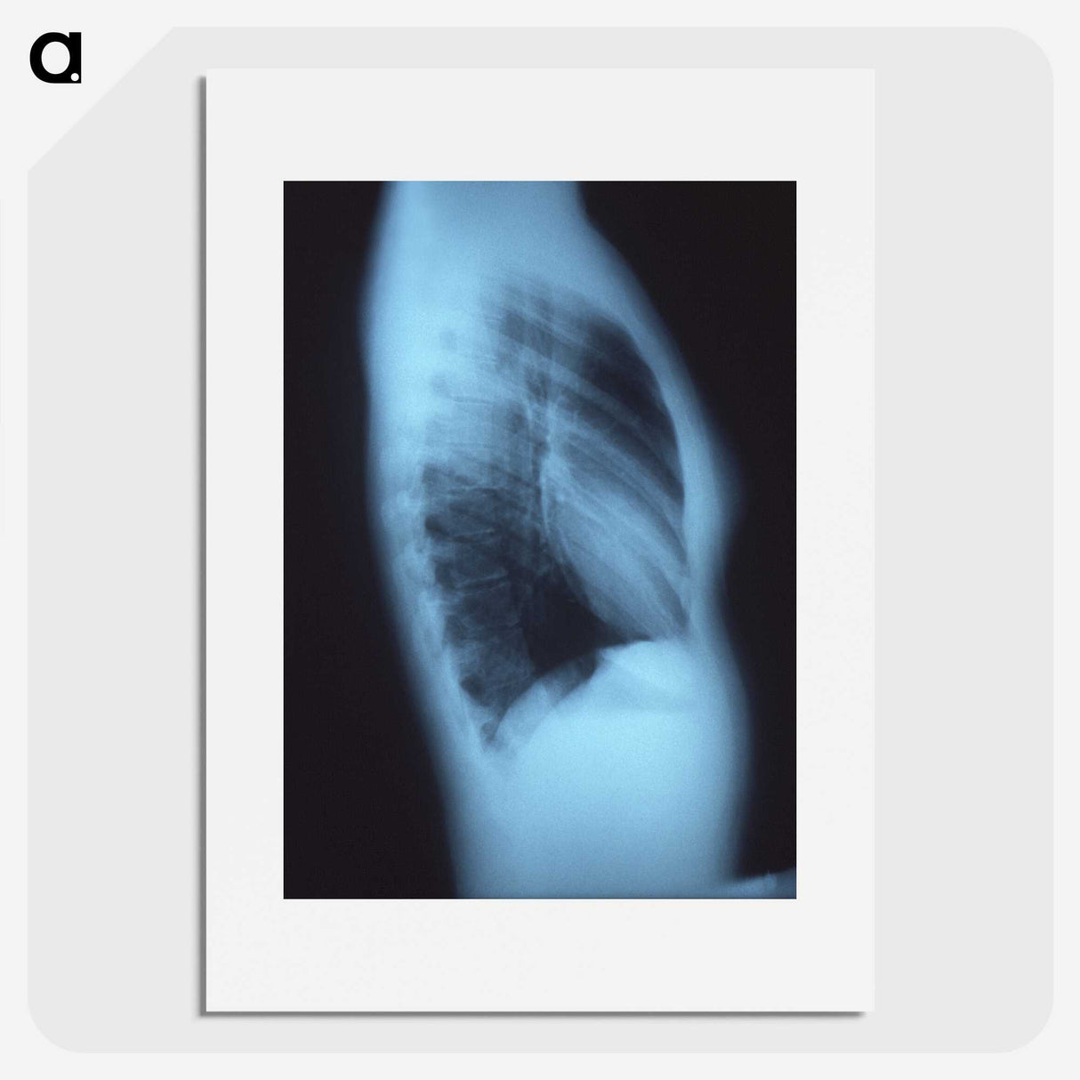 1-87_COVID-19_picture