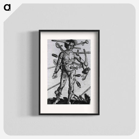 アートポスター-Wound Man
 - 国立医学図書館 Poster.