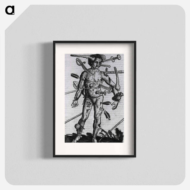 アートポスター-Wound Man
 - 国立医学図書館 Poster.