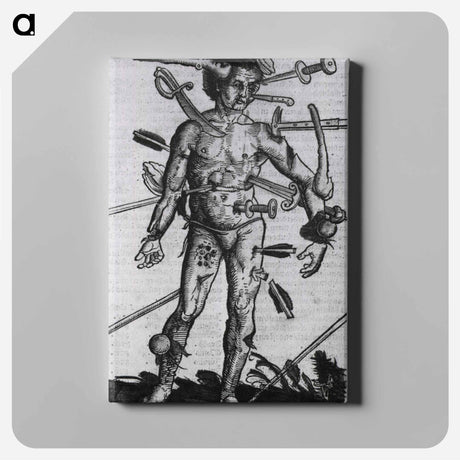 アートパネル-Wound Man
 - 国立医学図書館 Canvas.