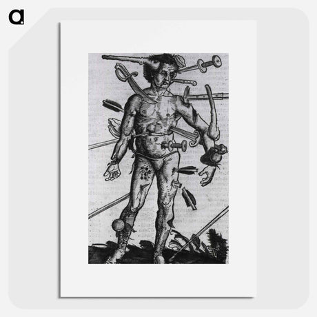アートポスター-Wound Man
 - 国立医学図書館 Poster.