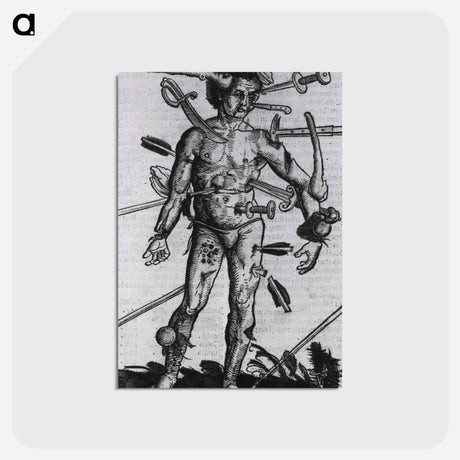 アートポストカード-Wound Man
 - 国立医学図書館 Postcard.