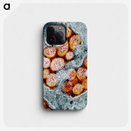 1-92_COVID-19_phone