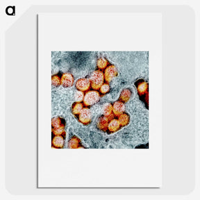 1-92_COVID-19_picture