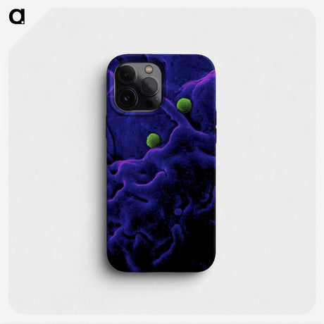 1-93_COVID-19_phone