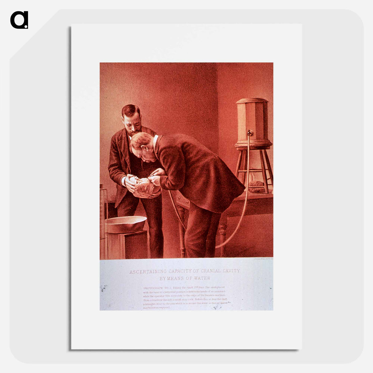 アートポスター-Ascertaining Capacity of Cranial Cavity by Means of Water: Photograph No. 2
 - 国立医学図書館 Poster.