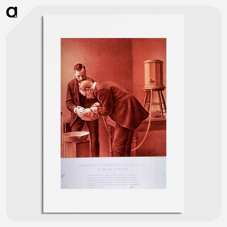 アートポスター-Ascertaining Capacity of Cranial Cavity by Means of Water: Photograph No. 2
 - 国立医学図書館 Poster.