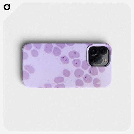 2-24_COVID-19_phone